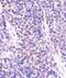 DEP Domain Containing MTOR Interacting Protein antibody, NBP1-49674, Novus Biologicals, Immunohistochemistry paraffin image 