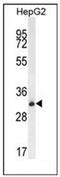 Olfactory Receptor Family 4 Subfamily K Member 5 antibody, AP53061PU-N, Origene, Western Blot image 