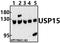 Ubiquitin Specific Peptidase 15 antibody, A03057, Boster Biological Technology, Western Blot image 