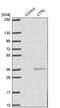 Chymotrypsin-like protease CTRL-1 antibody, NBP1-87520, Novus Biologicals, Western Blot image 