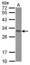 Caseinolytic Mitochondrial Matrix Peptidase Proteolytic Subunit antibody, LS-C155399, Lifespan Biosciences, Western Blot image 