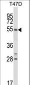 Nuclear receptor subfamily 1 group D member 1 antibody, LS-C162983, Lifespan Biosciences, Western Blot image 