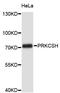 Protein Kinase C Substrate 80K-H antibody, STJ25135, St John