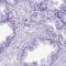 Mesenchyme Homeobox 2 antibody, HPA053793, Atlas Antibodies, Immunohistochemistry frozen image 