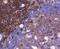 CD38 Molecule antibody, A00193, Boster Biological Technology, Immunohistochemistry paraffin image 