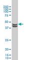 Casein Kinase 2 Alpha 1 antibody, MCA3031Z, Bio-Rad (formerly AbD Serotec) , Western Blot image 