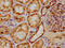 Proteasome Subunit Beta 2 antibody, LS-C211111, Lifespan Biosciences, Immunohistochemistry paraffin image 