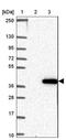 Solute Carrier Family 25 Member 42 antibody, NBP2-13325, Novus Biologicals, Immunohistochemistry paraffin image 