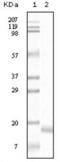 Synuclein Alpha antibody, abx010381, Abbexa, Enzyme Linked Immunosorbent Assay image 