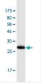 G6PT antibody, H00002542-M01-100ug, Novus Biologicals, Western Blot image 