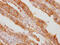 Eukaryotic Translation Initiation Factor 5A antibody, CSB-RA932542A0HU, Cusabio, Immunohistochemistry paraffin image 