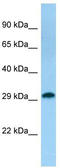 Translational Activator Of Cytochrome C Oxidase I antibody, TA331915, Origene, Western Blot image 