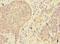 Abhydrolase Domain Containing 2 antibody, orb353755, Biorbyt, Immunohistochemistry paraffin image 