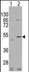 Aldehyde Dehydrogenase 5 Family Member A1 antibody, PA5-71909, Invitrogen Antibodies, Western Blot image 
