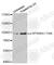 Ribosomal Protein S6 Kinase A1 antibody, AP0166, ABclonal Technology, Western Blot image 