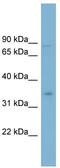 Glycerol-3-Phosphate Dehydrogenase 2 antibody, TA335233, Origene, Western Blot image 