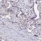 Lin-28 Homolog B antibody, NBP1-85438, Novus Biologicals, Immunohistochemistry frozen image 