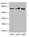 Zinc Finger Protein 549 antibody, LS-C676755, Lifespan Biosciences, Western Blot image 