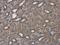 Citrin antibody, GTX109001, GeneTex, Immunohistochemistry paraffin image 