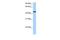 RNA Binding Motif Protein 42 antibody, GTX47253, GeneTex, Western Blot image 