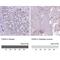 FAS antibody, NBP2-49213, Novus Biologicals, Immunohistochemistry paraffin image 