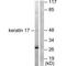 Keratin 17 antibody, A02289, Boster Biological Technology, Western Blot image 