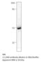 Chimerin 2 antibody, MBS540311, MyBioSource, Western Blot image 