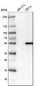Lysophosphatidylcholine Acyltransferase 2 antibody, PA5-52481, Invitrogen Antibodies, Western Blot image 