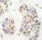 Cyclin Dependent Kinase 8 antibody, A302-501A, Bethyl Labs, Immunohistochemistry paraffin image 