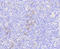 Mixed Lineage Kinase Domain Like Pseudokinase antibody, STJ113151, St John