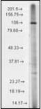 Transient Receptor Potential Cation Channel Subfamily M Member 2 antibody, orb95888, Biorbyt, Western Blot image 