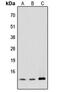 Mediator Complex Subunit 11 antibody, abx121642, Abbexa, Western Blot image 