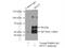 DNA Nucleotidylexotransferase antibody, 17382-1-AP, Proteintech Group, Immunoprecipitation image 