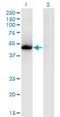 LXR antibody, H00010062-M08, Novus Biologicals, Western Blot image 