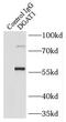 Diacylglycerol O-Acyltransferase 1 antibody, FNab02349, FineTest, Immunoprecipitation image 