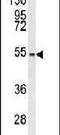 CCZ1 Homolog, Vacuolar Protein Trafficking And Biogenesis Associated antibody, PA5-25368, Invitrogen Antibodies, Western Blot image 