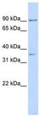 Nuclear Factor Of Activated T Cells 1 antibody, TA345590, Origene, Western Blot image 