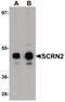 Secernin 2 antibody, PA5-20993, Invitrogen Antibodies, Western Blot image 