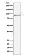 RAN Binding Protein 3 antibody, M06252, Boster Biological Technology, Western Blot image 