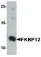 FKBP Prolyl Isomerase 1A antibody, LS-C336171, Lifespan Biosciences, Western Blot image 