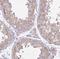 PARN Like, Ribonuclease Domain Containing 1 antibody, NBP2-13781, Novus Biologicals, Immunohistochemistry frozen image 