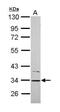 Cytochrome B5 Reductase 1 antibody, PA5-31508, Invitrogen Antibodies, Western Blot image 