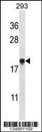 ER Membrane Protein Complex Subunit 4 antibody, 57-934, ProSci, Western Blot image 