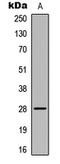 ELOVL Fatty Acid Elongase 5 antibody, LS-C358971, Lifespan Biosciences, Western Blot image 