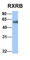 Retinoid X Receptor Beta antibody, orb330430, Biorbyt, Western Blot image 