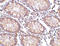 Protein Tyrosine Kinase 7 (Inactive) antibody, LS-C34732, Lifespan Biosciences, Immunohistochemistry paraffin image 