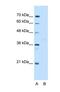 GDP-Mannose Pyrophosphorylase B antibody, NBP1-55168, Novus Biologicals, Western Blot image 