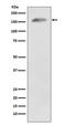 APC Regulator Of WNT Signaling Pathway antibody, M00008, Boster Biological Technology, Western Blot image 