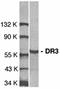 TNF Receptor Superfamily Member 25 antibody, orb74338, Biorbyt, Western Blot image 