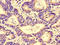 Golgi Associated, Gamma Adaptin Ear Containing, ARF Binding Protein 1 antibody, orb46607, Biorbyt, Immunohistochemistry paraffin image 